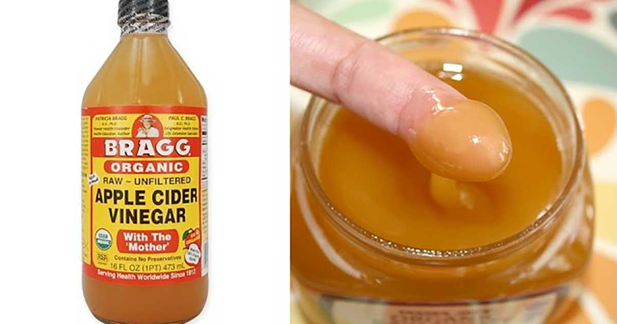 Apple Cider Vinegar And Blood Pressure
 How to Take Apple Cider Vinegar to Lose Weight and Reduce