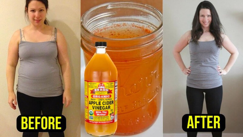 Apple Cider Vinegar And Weight Loss
 Apple Cider Vinegar Weight Loss Evidence to Lose in a week