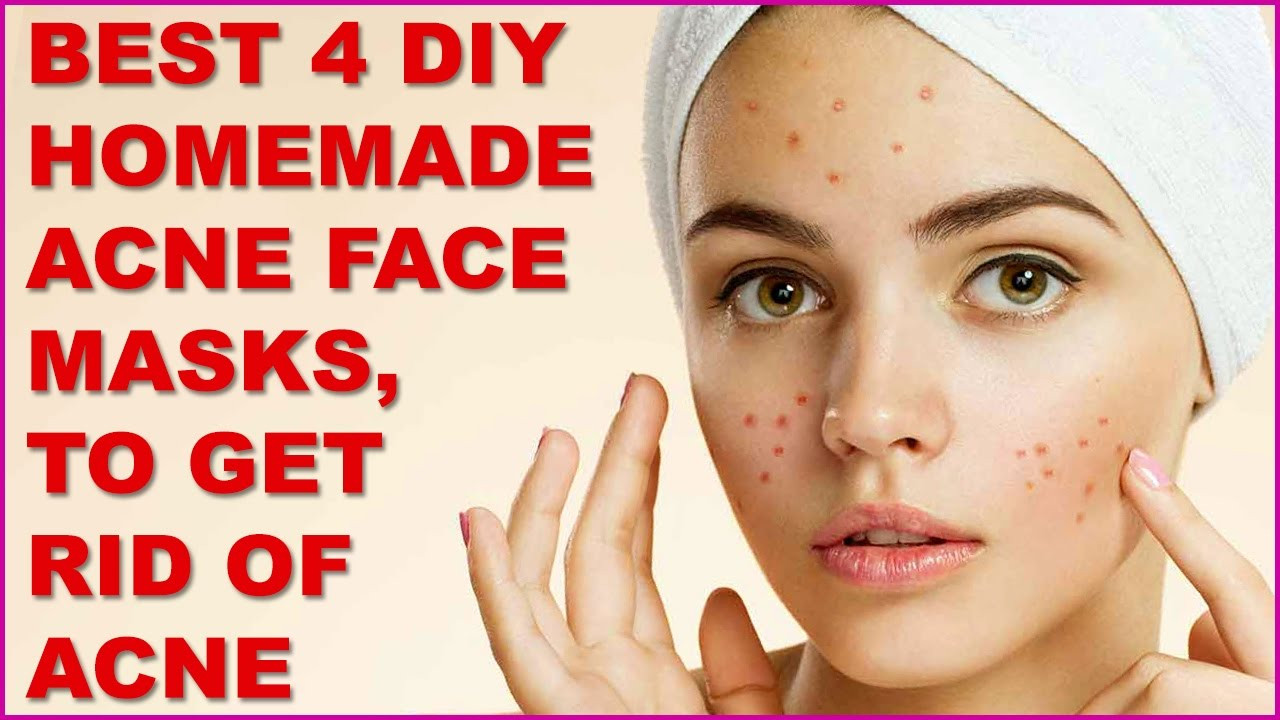 DIY Acne Face Mask
 Best 4 DIY Homemade Acne Face Masks To Get Rid Acne