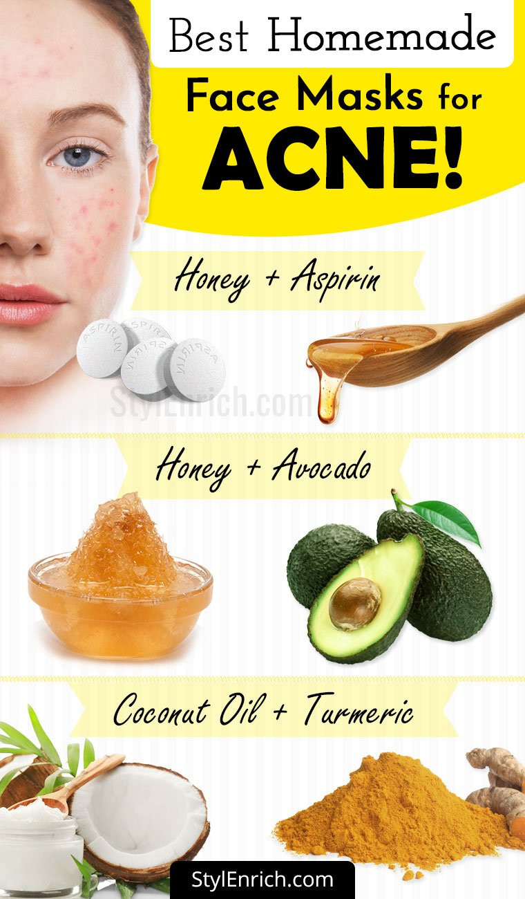 DIY Acne Face Mask
 Homemade Face Mask For Acne Treatment At Home