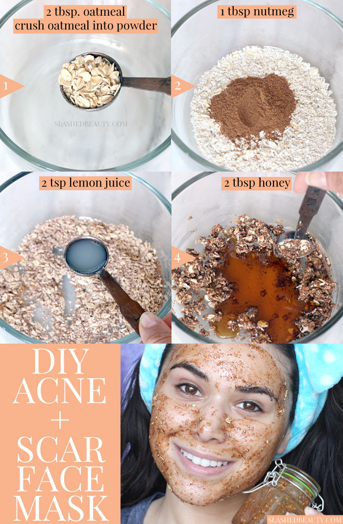 DIY Acne Face Mask
 Best DIY Face Mask for Acne & Scars