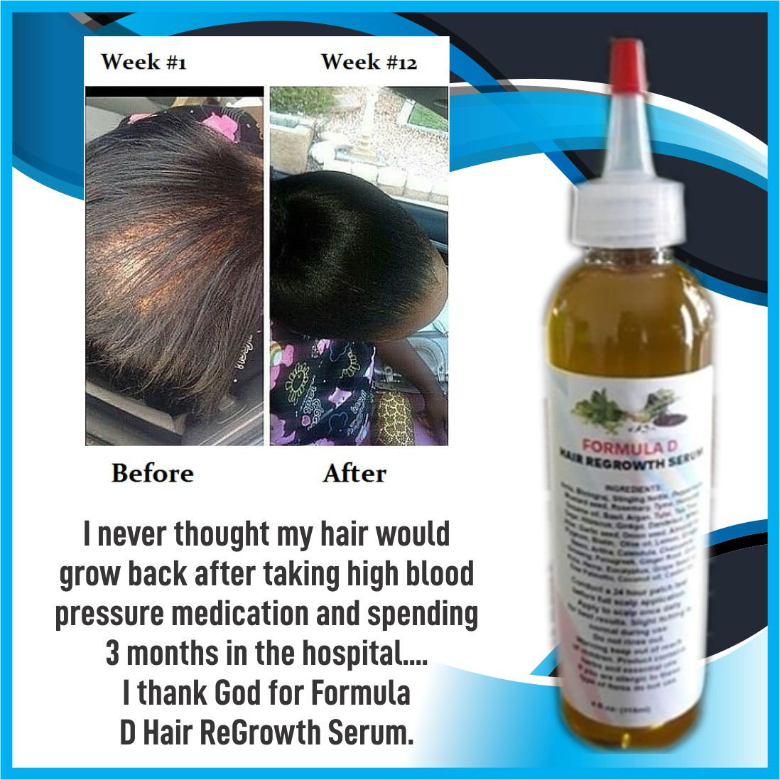 DIY Hair Growth Formula
 Hair Oil Formula D Hair ReGrowth Serum For Fast Hair