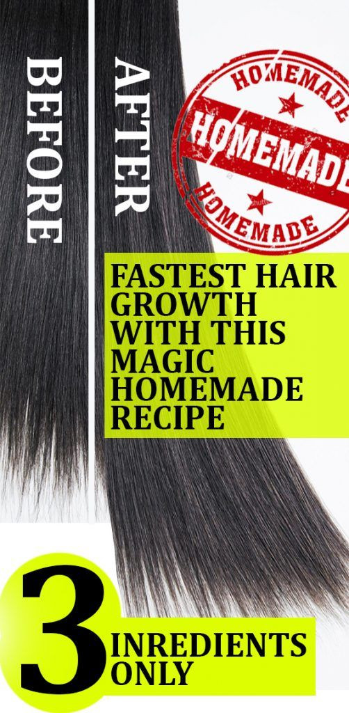 DIY Hair Growth Formula
 The Magic Homemade Recipe For Fastest Hair Growth 3