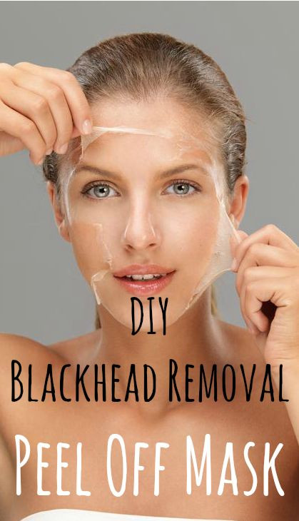DIY Masks For Blackheads
 Best DIY Face Masks For Blackheads