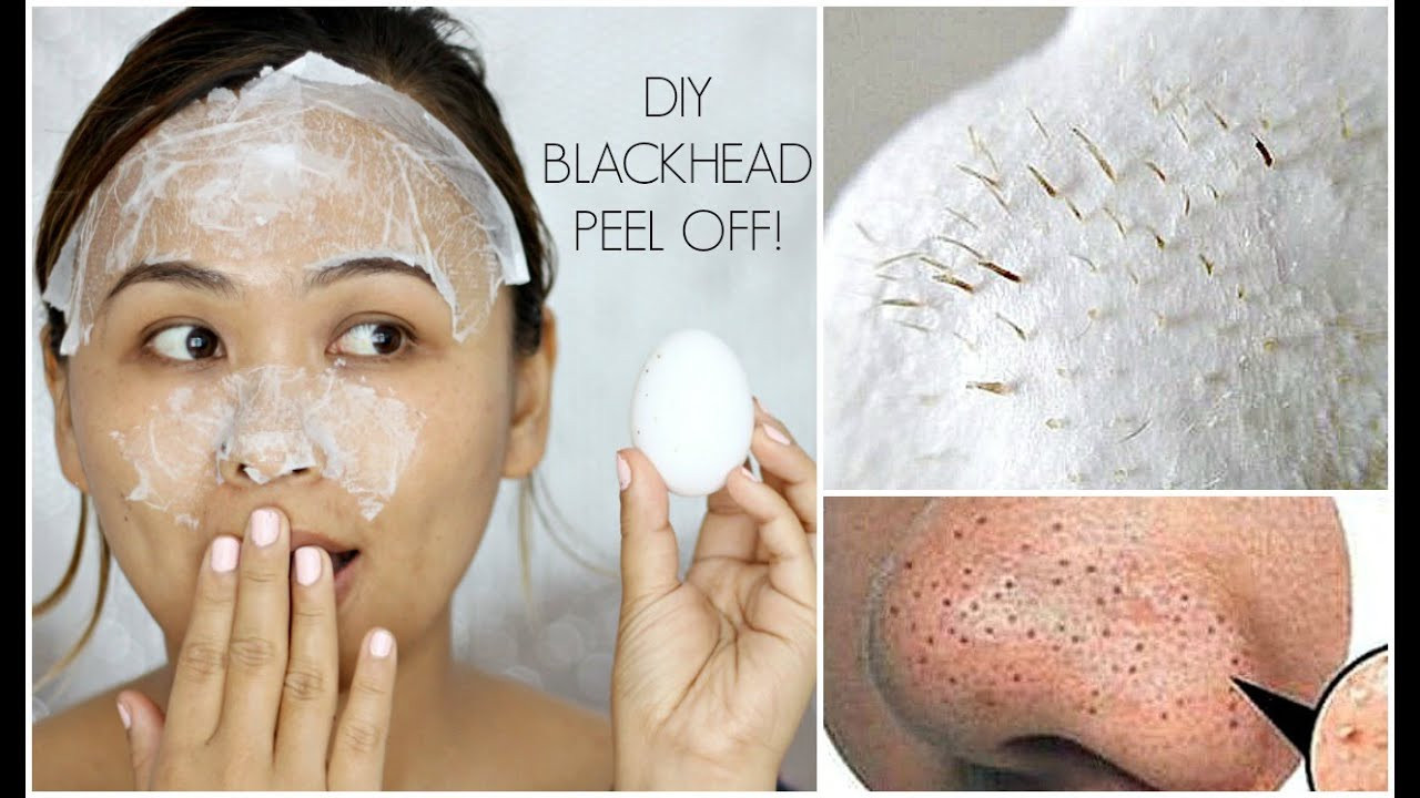 DIY Masks For Blackheads
 The 23 Best Ideas for Diy Peel f Face Mask for