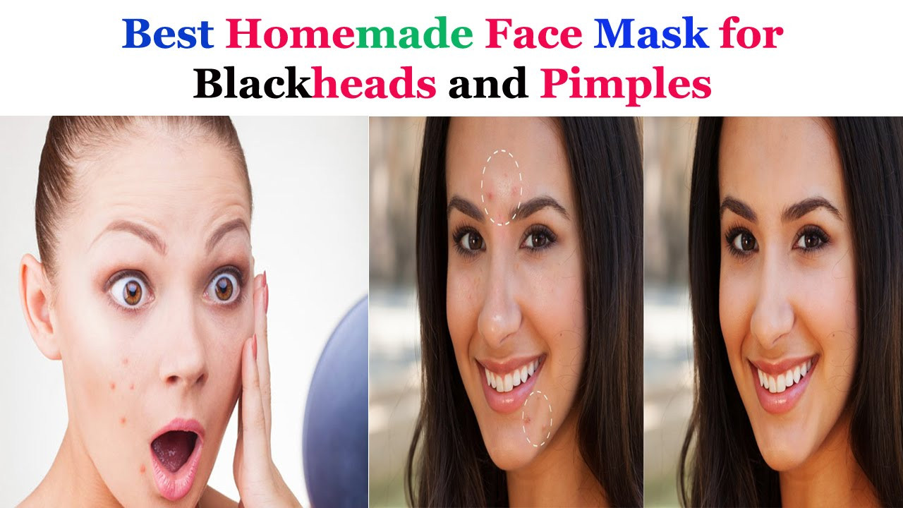 DIY Masks For Blackheads
 Best Homemade Face mask for Blackheads and Pimples