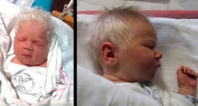 White Hair In Children
 Baby Was Born With White Hair But When Doctors Reveal The