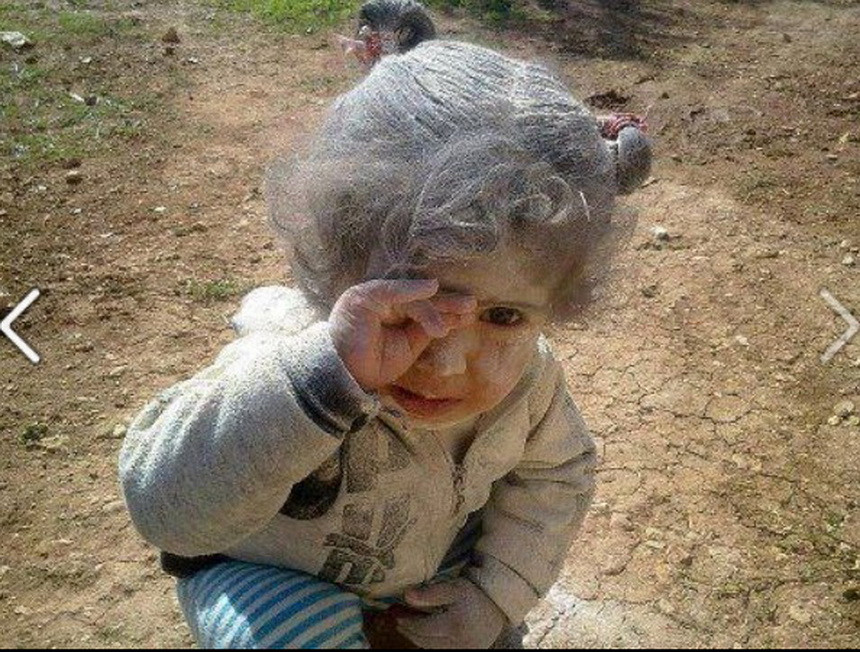 White Hair In Children
 Syrian Childhood