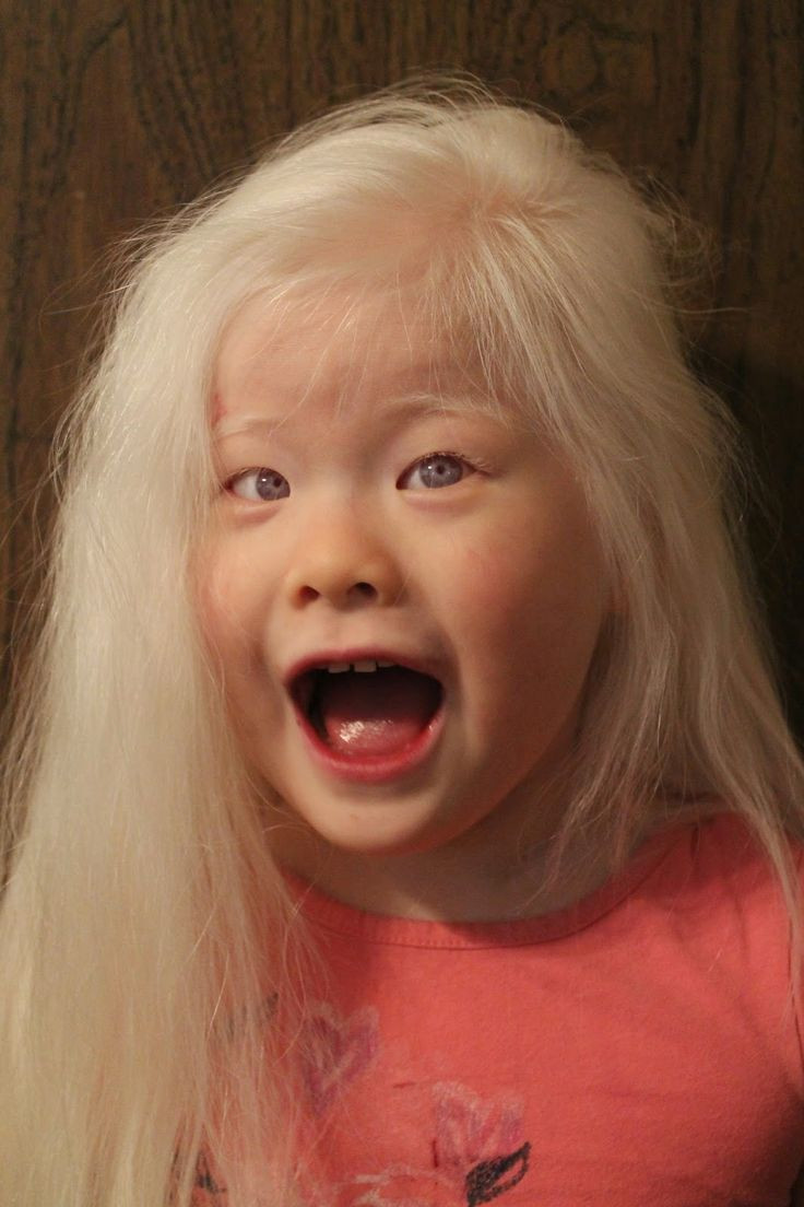 White Hair In Children
 200 best beautiful albino people images on Pinterest